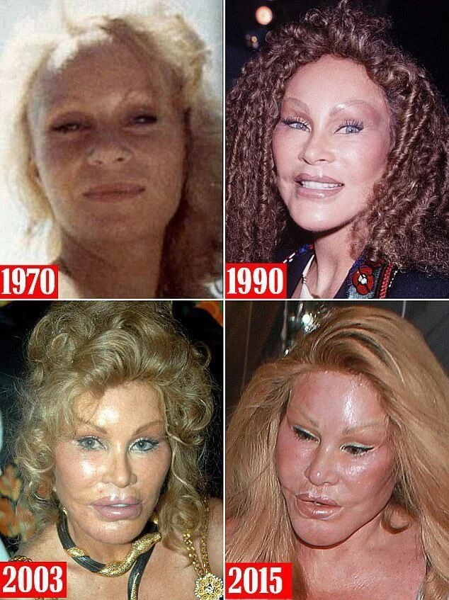 the fascinating life of jocelyn wildenstein catwoman v0 xob7eio1ffba1 converted 1